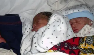 Quadruplets born in rural DRC, with help of emergency obstetric…
